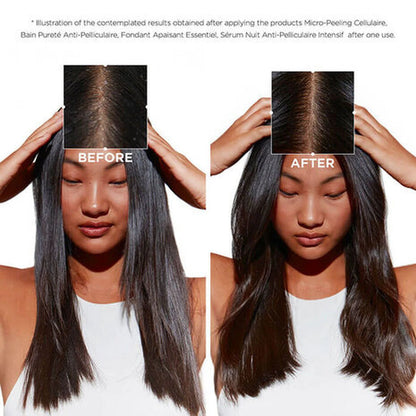 Symbiose Cellulaire Nuit Anti-Dandruff Scalp Serum Intensif