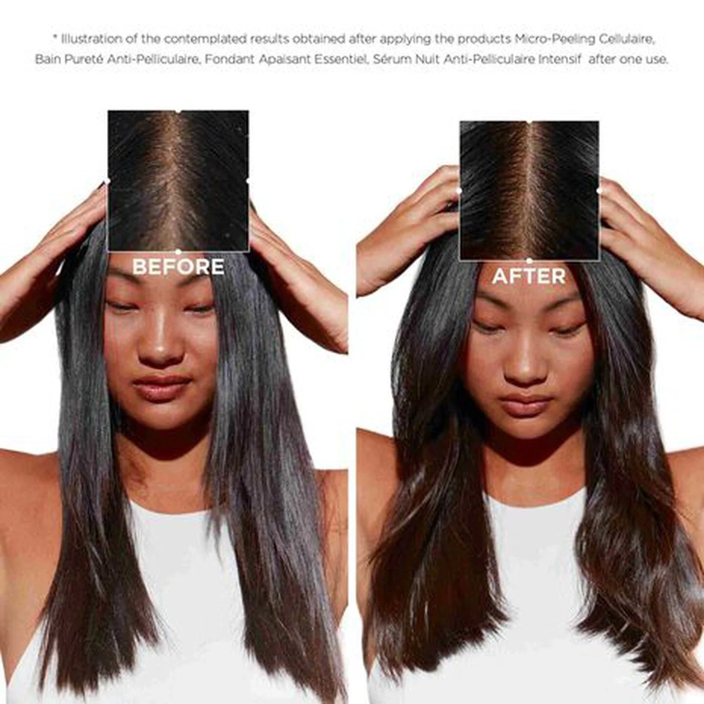 Symbiose Pureté Anti-Dandruff Shampoo for Oily Scalp