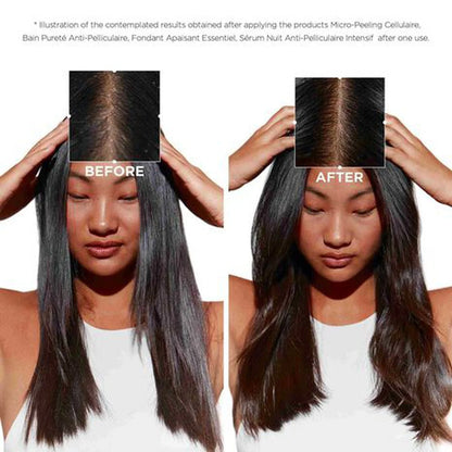 Symbiose Pureté Anti-Dandruff Shampoo for Oily Scalp